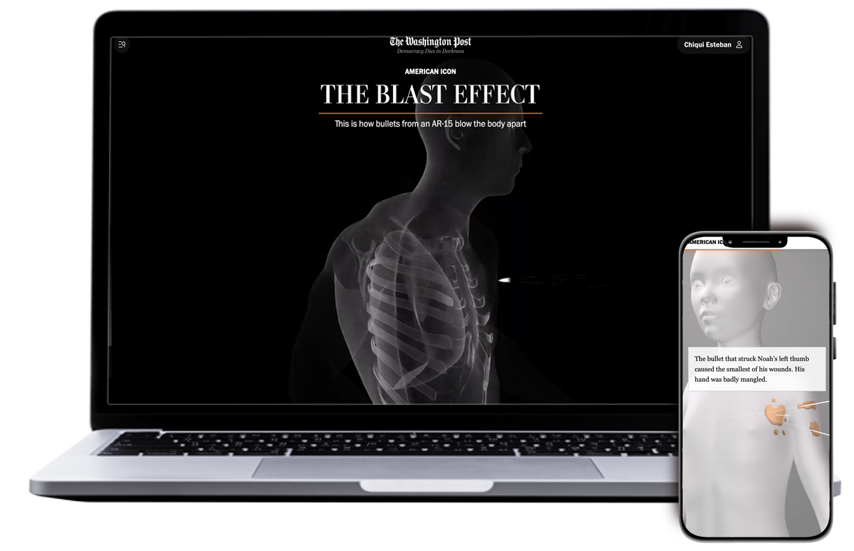 A computer showing a x-ray body under the title 'The Blast Effect' with a black background and a smartphoen standing showing a 3d model of a boy with orange marks and a small text over it